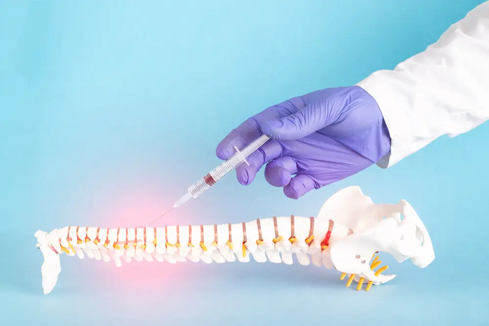 The Long-Term Benefits of Facet Joint Injections for Spinal Pain
