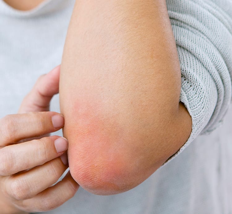 Why Is My Skin So Itchy Even When There’s No Rash