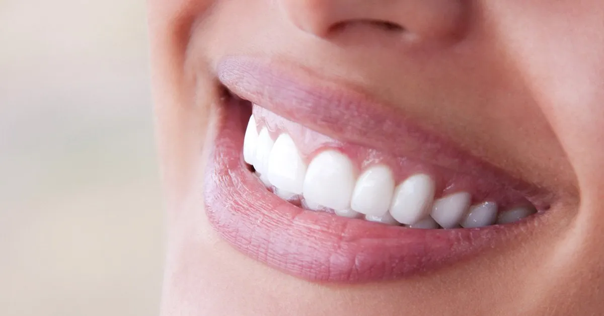 Exploring the Benefits of Porcelain Veneers for a Stunning Smile